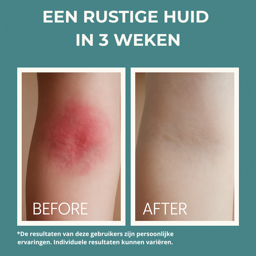 EEN RUSTIGE HUID IN 3 WEKEN.png__PID:7ca9e944-dad1-4b94-b513-0e6566a77726