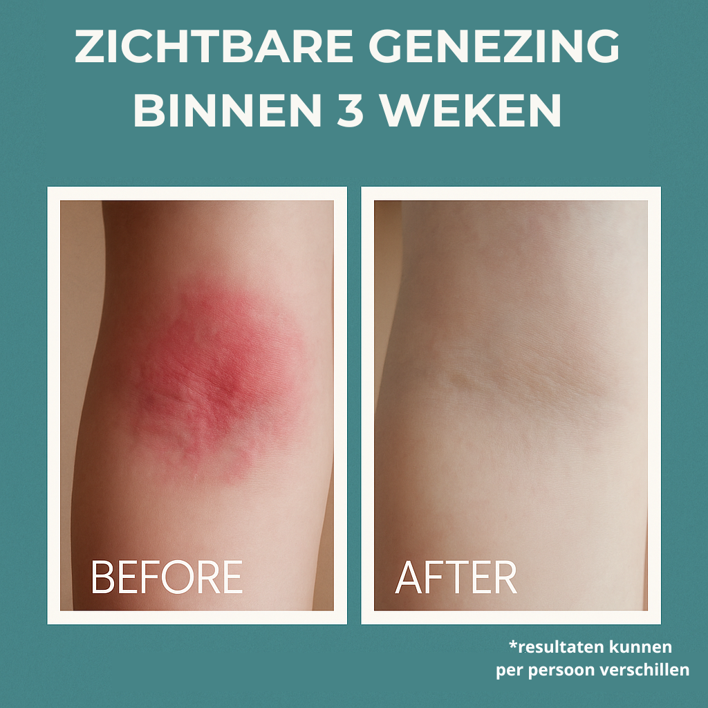 Sea Soothing - 100% Natuurlijk Zeewater tegen Eczeem