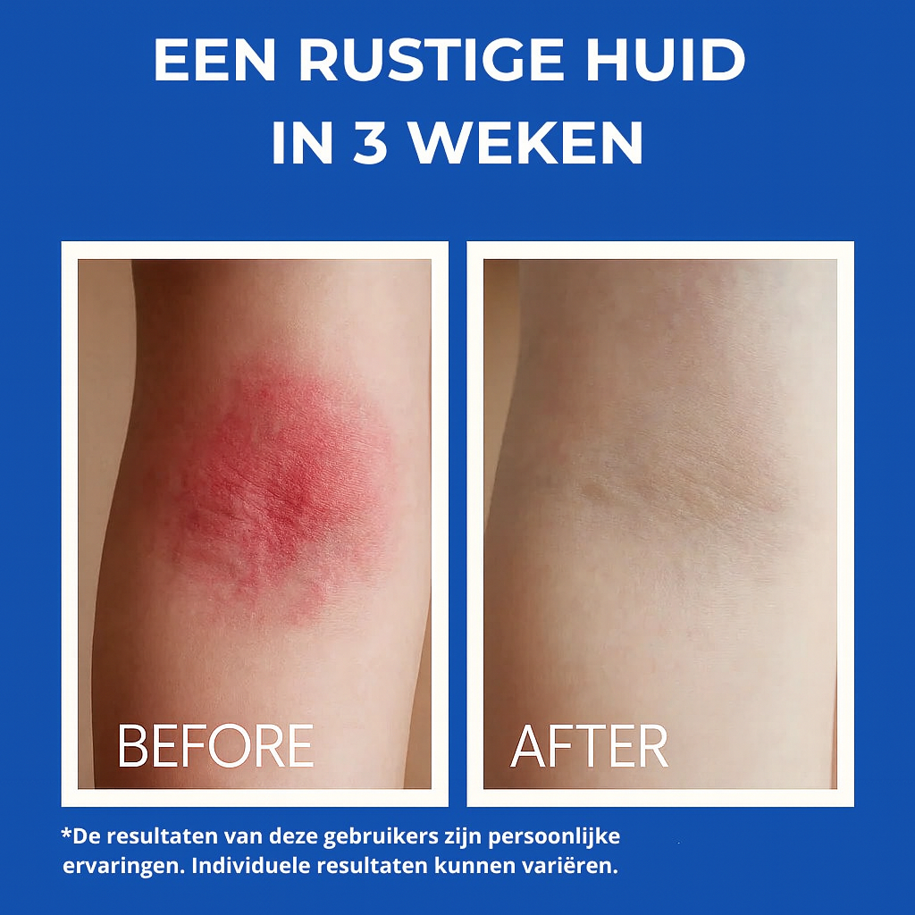 Sea Soothing - 100% Natuurlijk Zeewater voor Gevoelige Huid